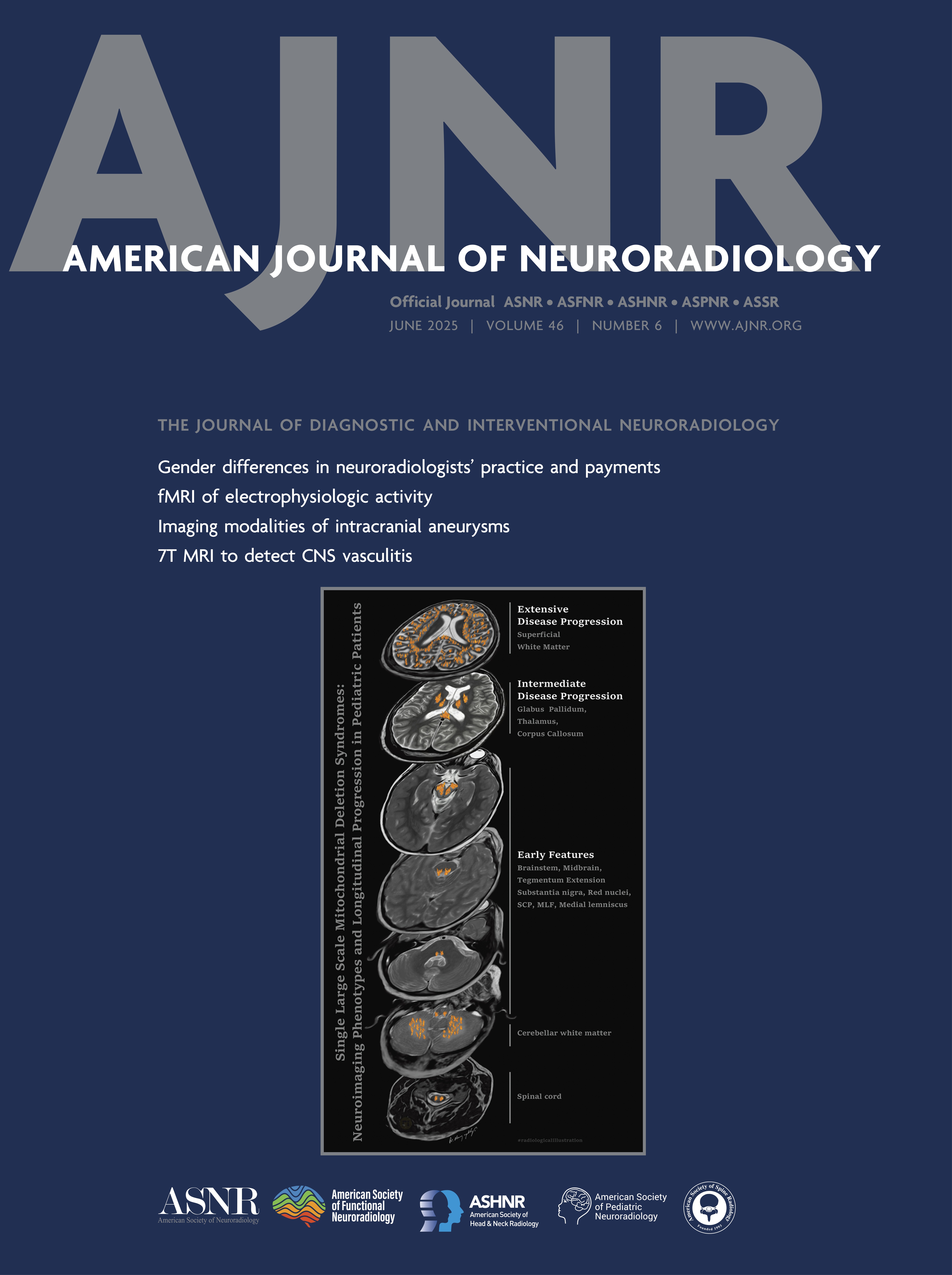 American Journal of Neuroradiology