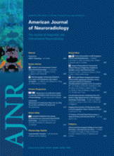 American Journal of Neuroradiology: 31 (8)