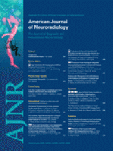 American Journal of Neuroradiology: 32 (8)