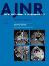 American Journal of Neuroradiology: 38 (12)