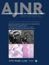 American Journal of Neuroradiology: 45 (11)